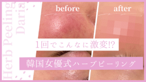 夜勤疲れにハーブの癒しを🍃横浜でお得にハーブピーリングができる「フェイシャルエステDaria」【クーポンあり】